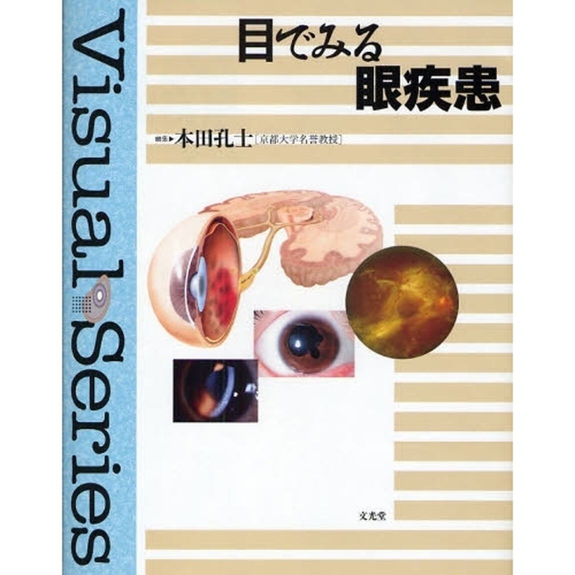 目でみる眼疾患