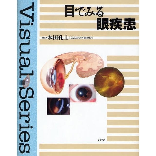 目でみる眼疾患