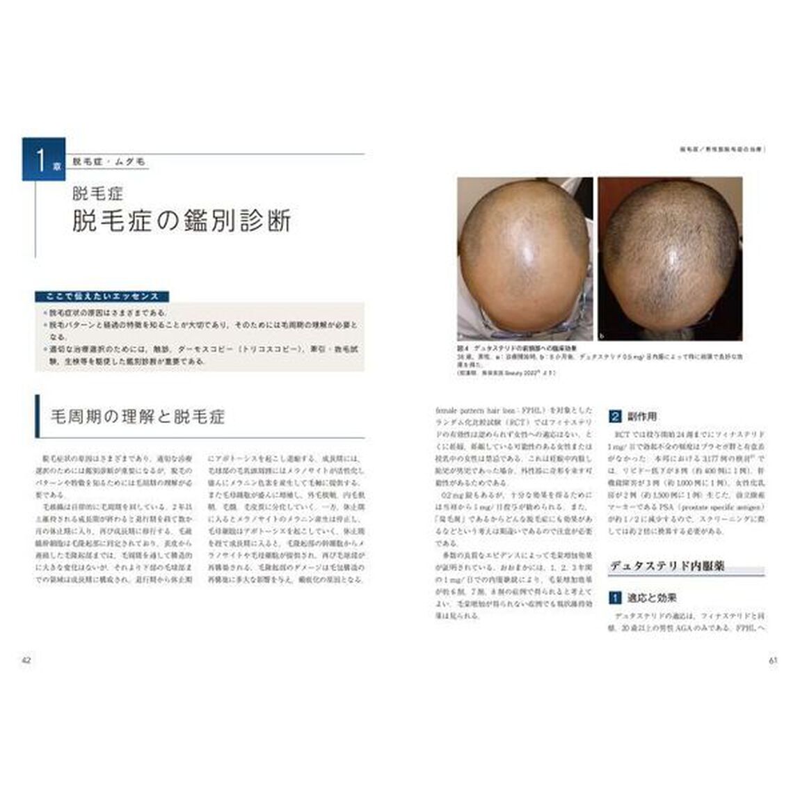 最新美容皮膚科学大系　５「脱毛・にきびの治療　美容皮膚科オールラウンド」