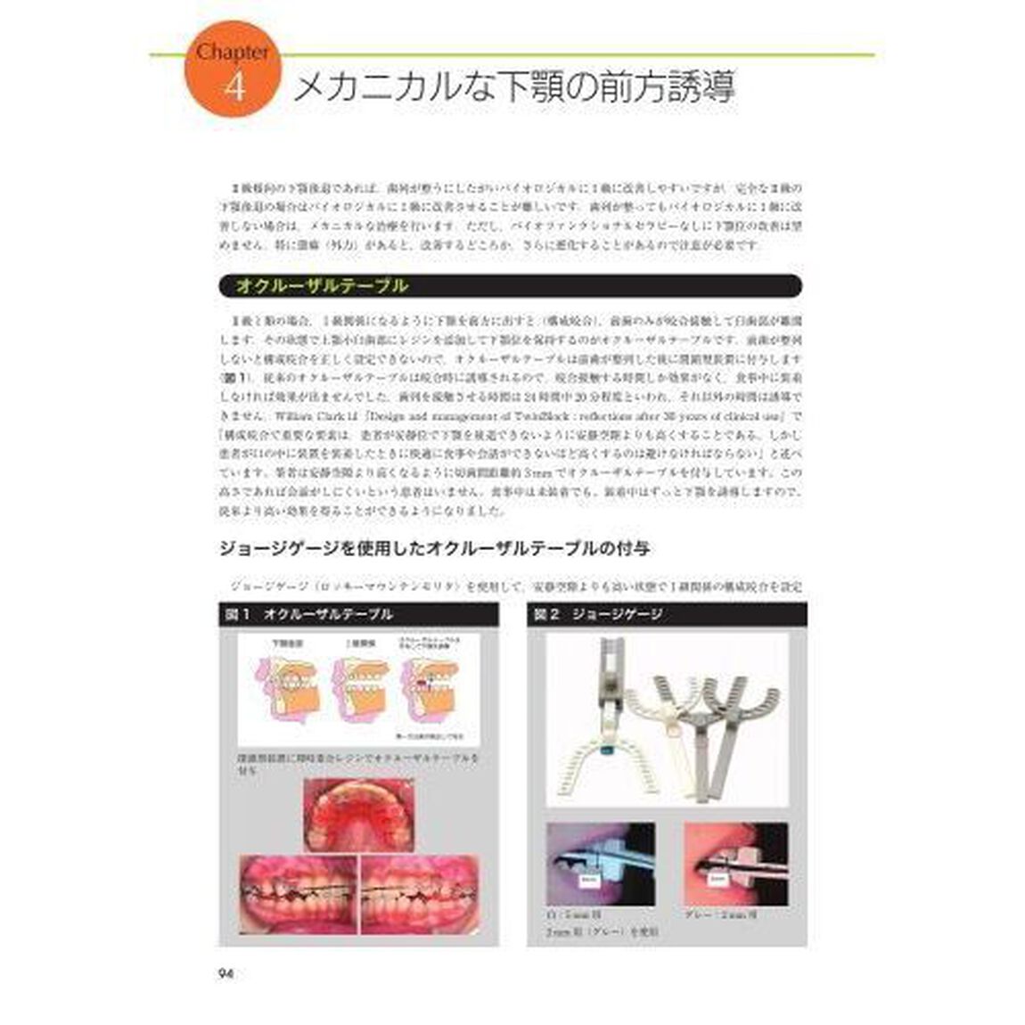 臨床家のための床矯正治療　不正咬合別のアプローチ　１「叢生・上顎前突・過蓋咬合」