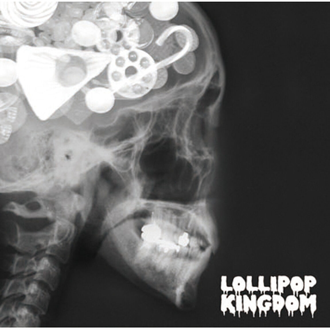 Lollipop　Kingdom（通常盤）（ＣＤ）