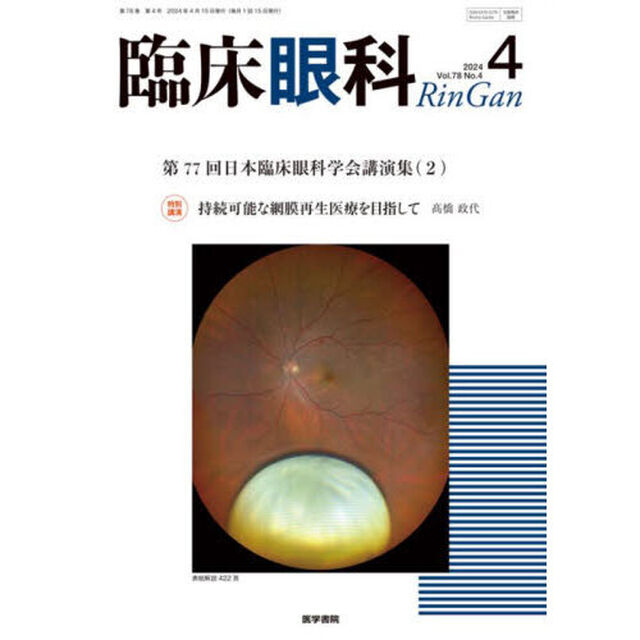 臨床眼科　2024年4月号