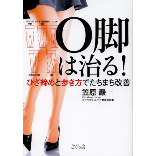 Ｏ脚は治る！　ひざ締めと歩き方でたちまち改善