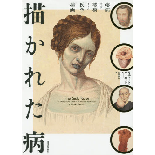 描かれた病　疾病および芸術としての医学挿画