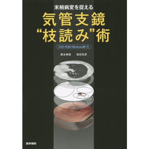 末梢病変を捉える気管支鏡“枝読み”術