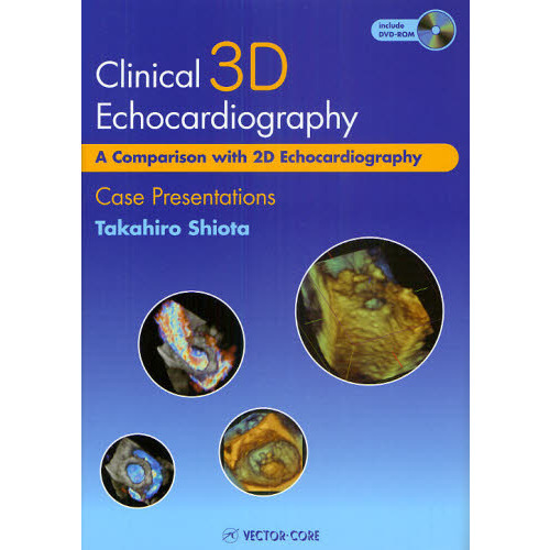 Ｃｌｉｎｉｃａｌ　３Ｄ　Ｅｃｈｏｃａｒｄｉｏｇｒａｐｈｙ　Ａ　Ｃｏｍｐａｒｉｓｏｎ　ｗｉｔｈ　２Ｄ　Ｅｃｈｏｃａｒｄｉｏｇｒａｐｈｙ