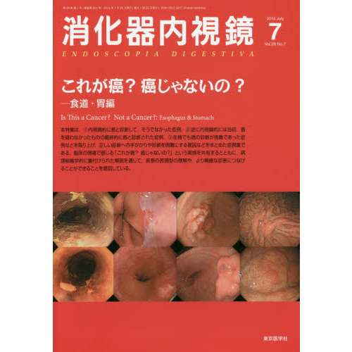 消化器内視鏡　Ｖｏｌ．２６Ｎｏ．７（２０１４Ｊｕｌｙ）