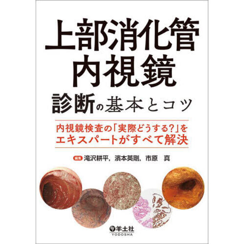 上部消化管内視鏡診断の基本とコツ　内視鏡検査の「実際どうする？」をエキスパートがすべて解決