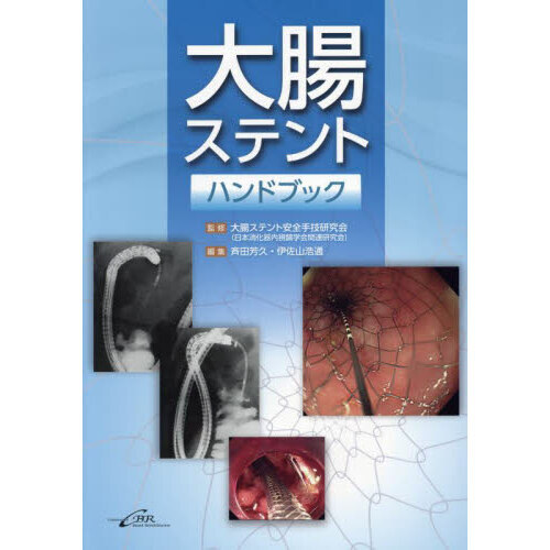 大腸ステントハンドブック
