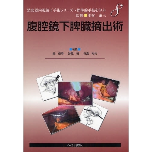 腹腔鏡下脾臓摘出術
