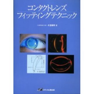 コンタクトレンズフィッティングテクニック