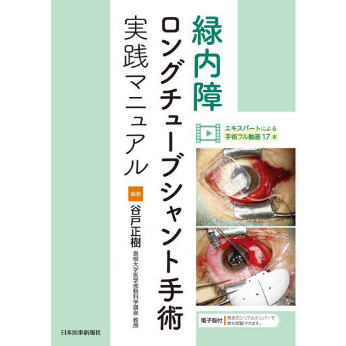 緑内障ロングチューブシャント手術実践マニュアル