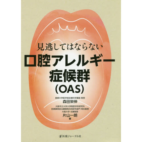 見逃してはならない口腔アレルギー症候群〈ＯＡＳ〉