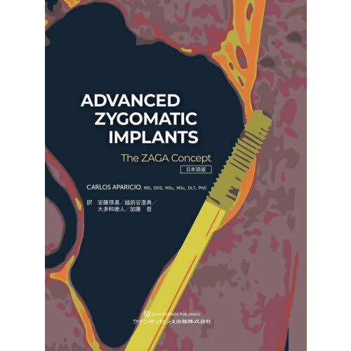 ＡＤＶＡＮＣＥＤ　ＺＹＧＯＭＡＴＩＣ　ＩＭＰＬＡＮＴＳ　Ｔｈｅ　ＺＡＧＡ　Ｃｏｎｃｅｐｔ　日本語版