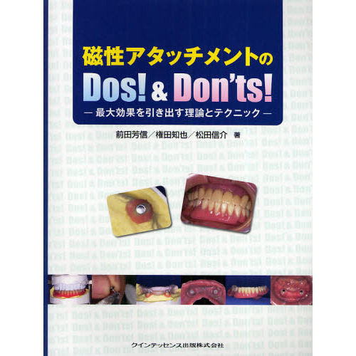 磁性アタッチメントのＤｏｓ！＆Ｄｏｎ’ｔｓ！　最大効果を引き出す理論とテクニック