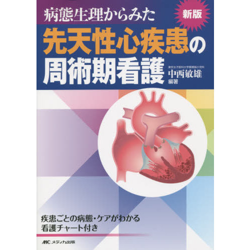 病態生理からみた先天性心疾患の周術期看護　疾患ごとの病態・ケアがわかる看護チャート付き