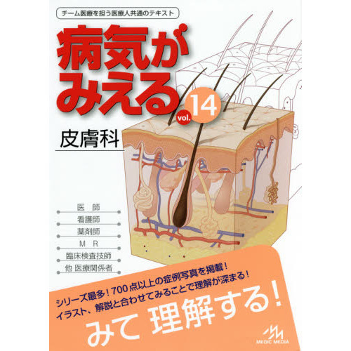 病気がみえる vol.14 皮膚科 - 通販｜セブンネットショッピング